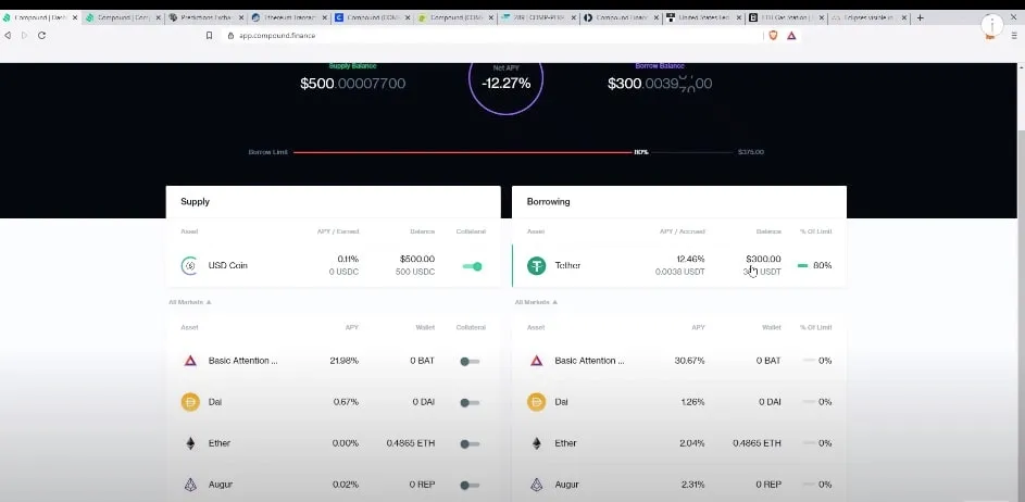 Net interest